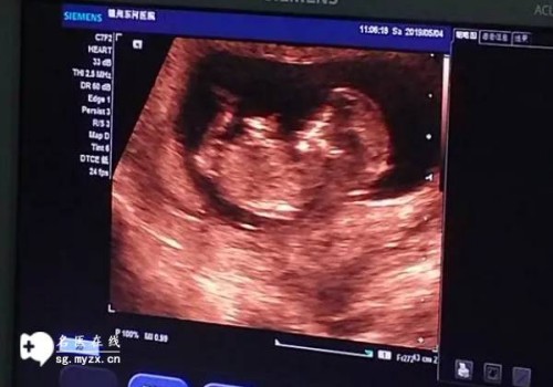 2023年徐州第一人民醫(yī)院試管嬰兒攻略，內(nèi)附成功率與費(fèi)用構(gòu)成！_1