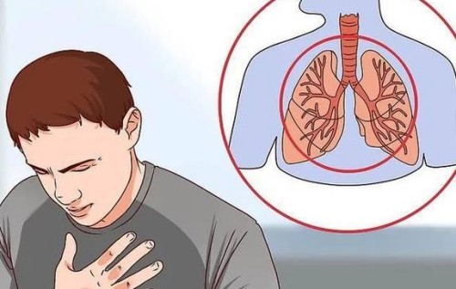 剖宮產(chǎn)后收腹帶需要戴多久？附佩戴時(shí)間及注意事項(xiàng)_1