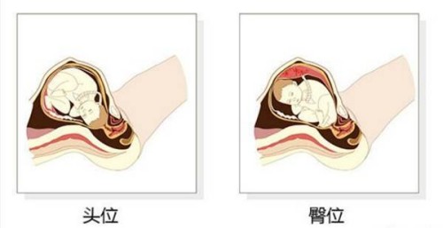 過(guò)來(lái)人分享艾灸治療月經(jīng)不調(diào)的效果，好不好一看便知
