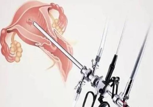 單身女性不要只看凍卵的利端，只要是手術(shù)就會(huì)有利弊