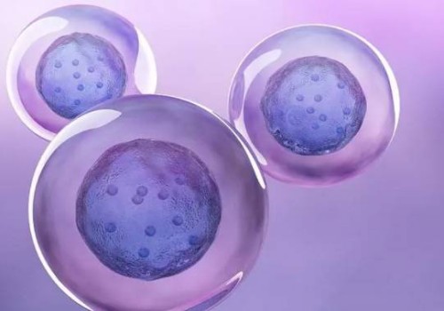 易發(fā)唐氏兒的孕婦群體，做好預(yù)防措施必不可少