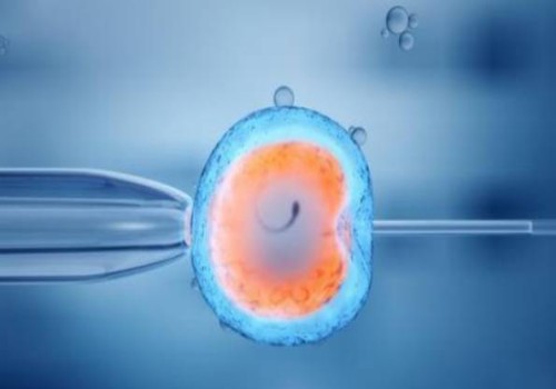 羊水穿刺染色體報(bào)告解讀：是男孩還是女孩一目了然！