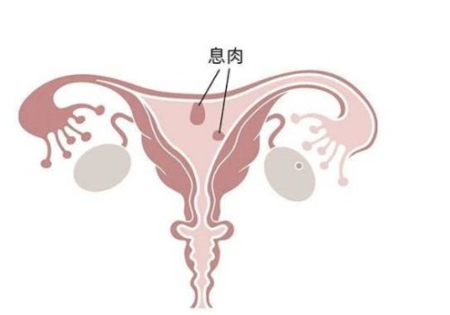 寧波正規(guī)助孕機(jī)構(gòu)：睪丸越多生育能力越強(qiáng)不可信，多睪癥有什么危害